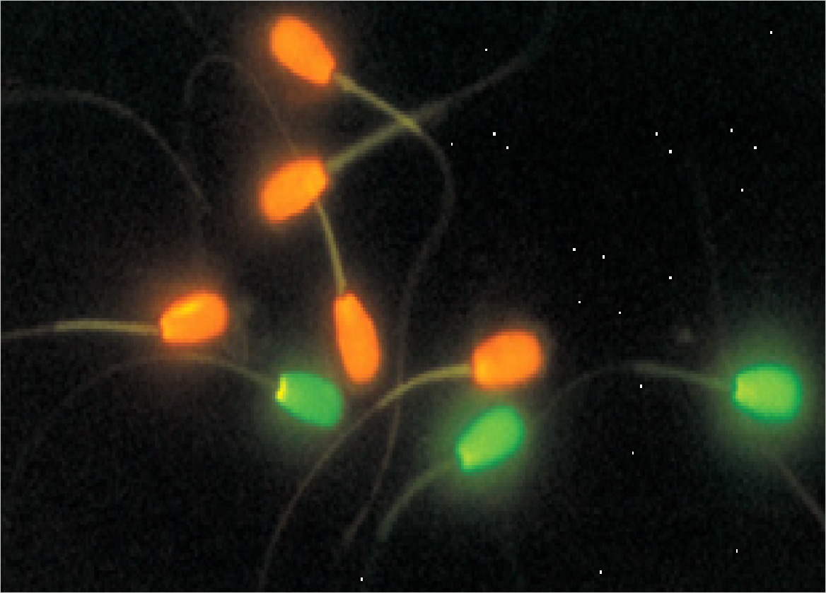 Spermії v polі zoru mіkroskopa pіslja farb fluorescentnimi barvnikami
